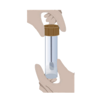 Hands carefully opening the stabilisation liquid tube from a gut microbiome home test kit before collecting a sample.